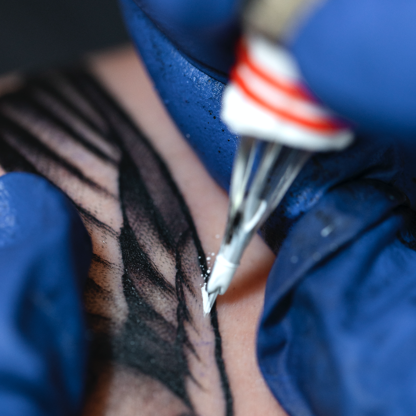 Needles
